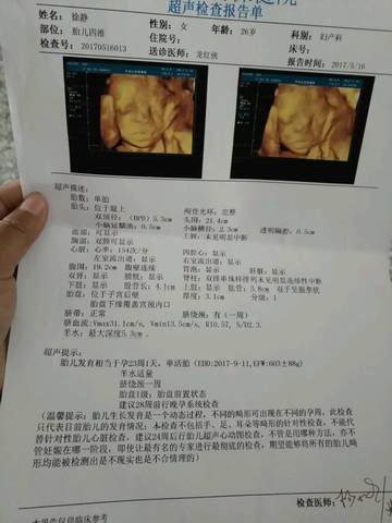 journal_insert_pic_745294064