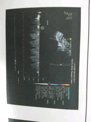 journal_insert_pic_747299278