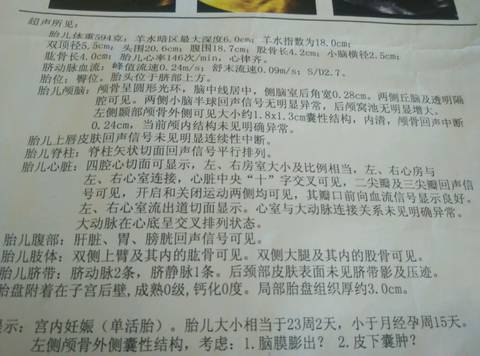 journal_insert_pic_749861829