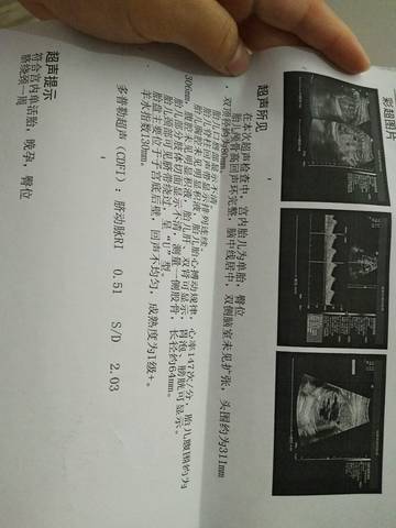 journal_insert_pic_750839021