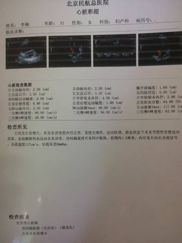journal_insert_pic_751090455
