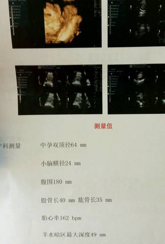 journal_insert_pic_753039049