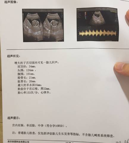 journal_insert_pic_755224732