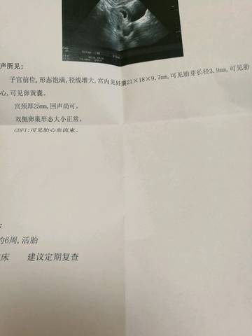 journal_insert_pic_758898995
