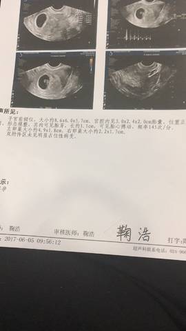 journal_insert_pic_760591100