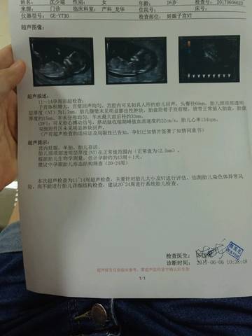 journal_insert_pic_761420405