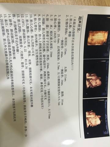 journal_insert_pic_762438049