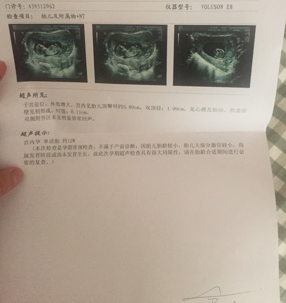 nt通过，传递点正能量。能看出男孩女孩吗？（自我娱乐一下）