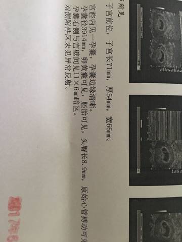 journal_insert_pic_763740336