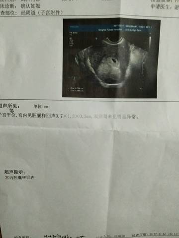 journal_insert_pic_765112678