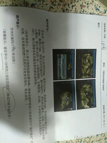 journal_insert_pic_768854386