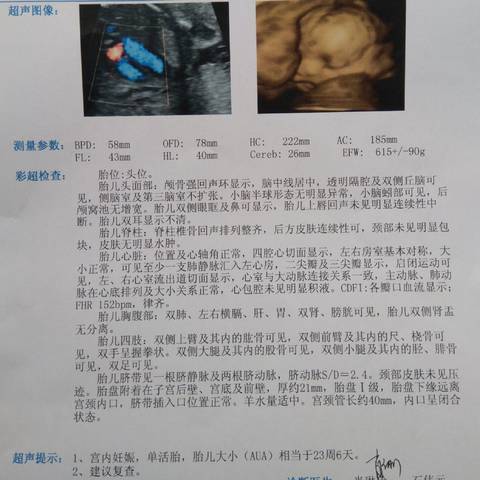 journal_insert_pic_770811653