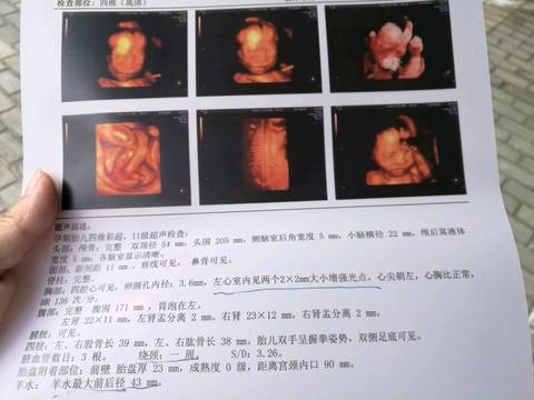 journal_insert_pic_771211760