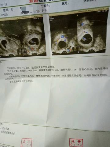 journal_insert_pic_771743555