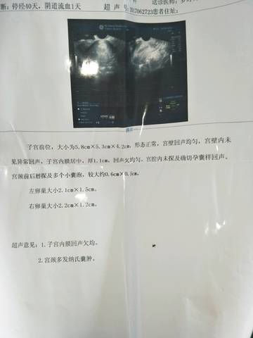 journal_insert_pic_778428786
