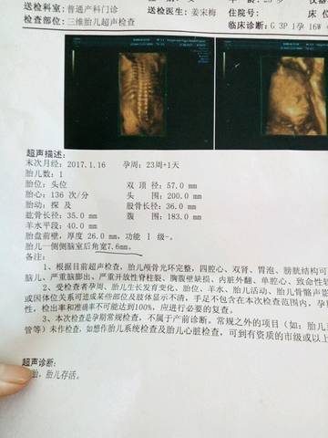 journal_insert_pic_778431311