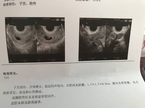 journal_insert_pic_780161708