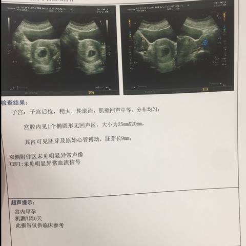 journal_insert_pic_781024014