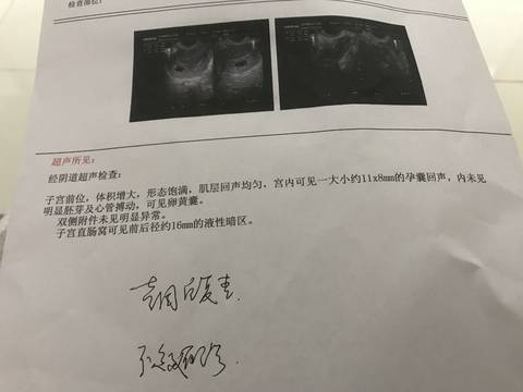 journal_insert_pic_781702677