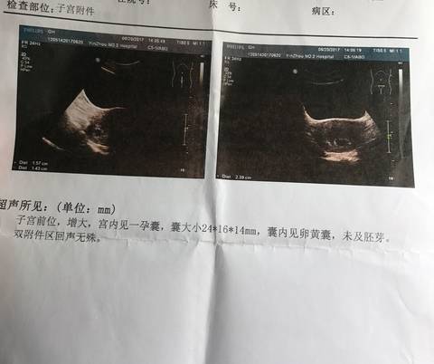 journal_insert_pic_783577677