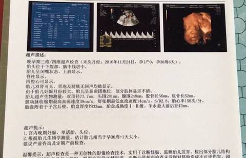 journal_insert_pic_784115912