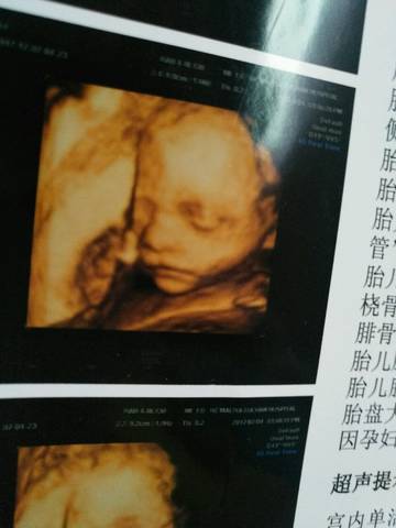 journal_insert_pic_784781998