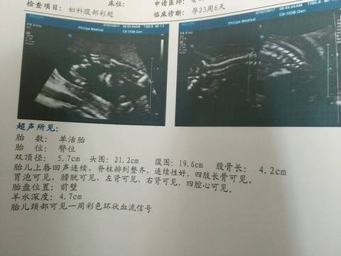 journal_insert_pic_786156872