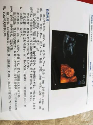 journal_insert_pic_786038717