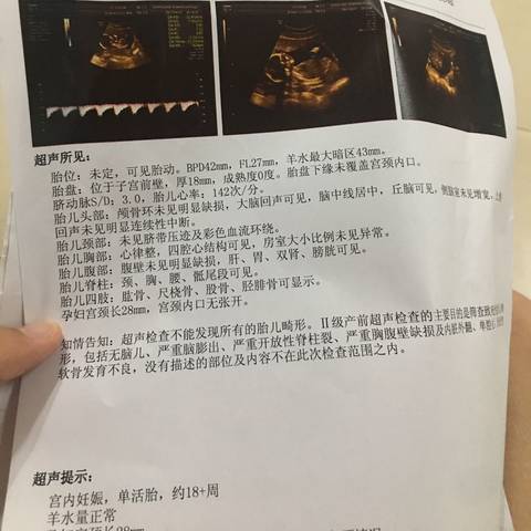 journal_insert_pic_787555482