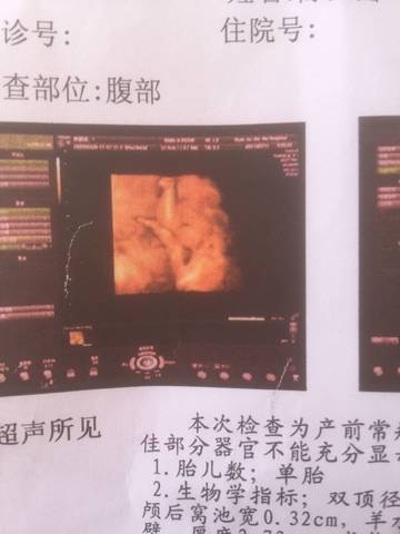 journal_insert_pic_789244286