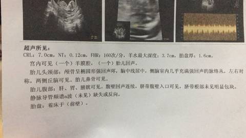 journal_insert_pic_789401297