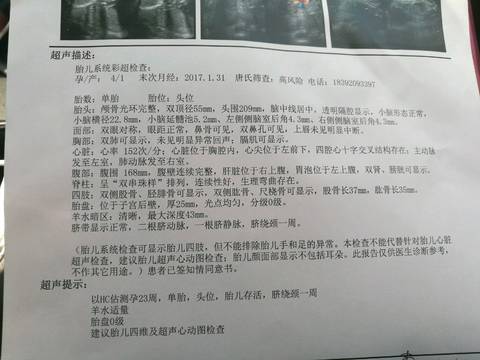 journal_insert_pic_789816051
