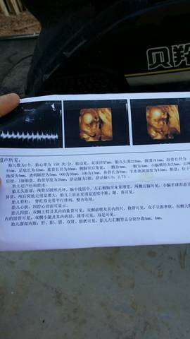 journal_insert_pic_790706950