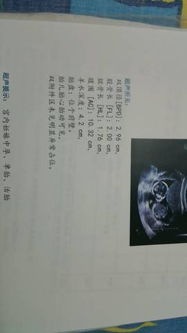 journal_insert_pic_791566147