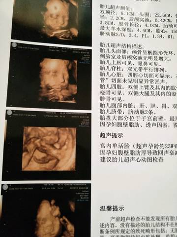 journal_insert_pic_793313168