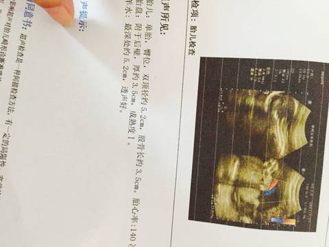 journal_insert_pic_793579939