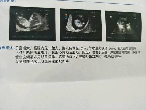 journal_insert_pic_794467243