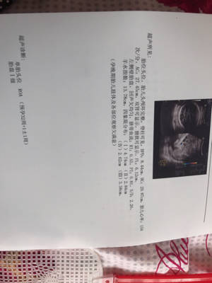 journal_insert_pic_794828558