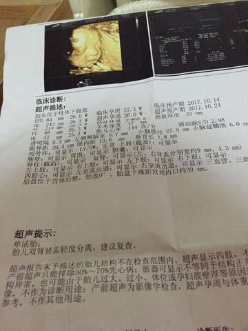 journal_insert_pic_796103181