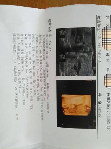 journal_insert_pic_795631184