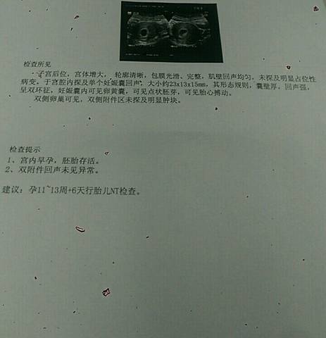journal_insert_pic_795813192