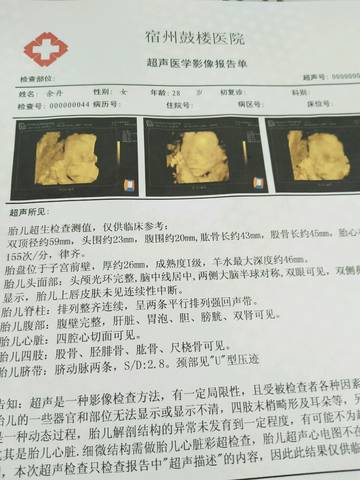 journal_insert_pic_796660438