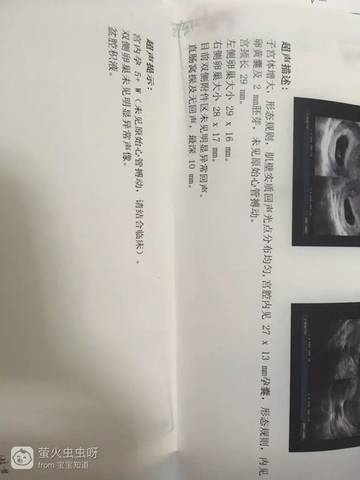 journal_insert_pic_796931834
