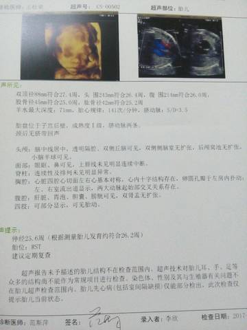 journal_insert_pic_798098350