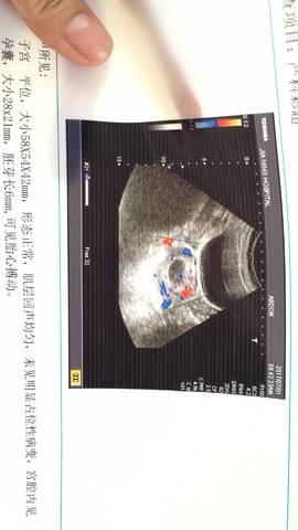 journal_insert_pic_800692852
