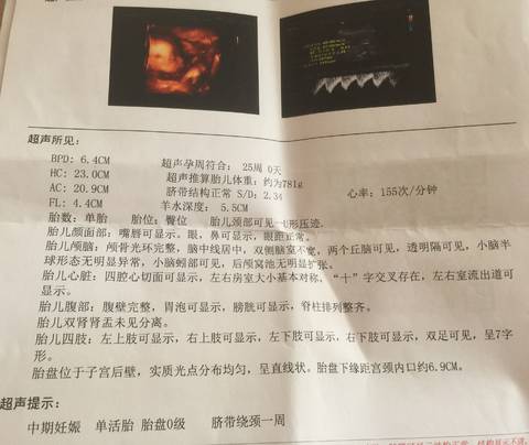 journal_insert_pic_802323868