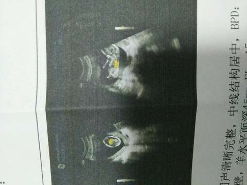 journal_insert_pic_802879620