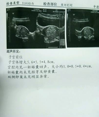 journal_insert_pic_807908602