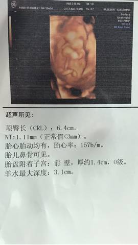 journal_insert_pic_808216334