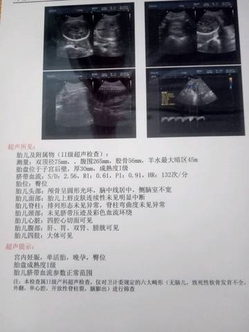 journal_insert_pic_808087390